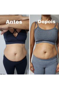 antes e depois