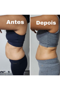 antes e depois