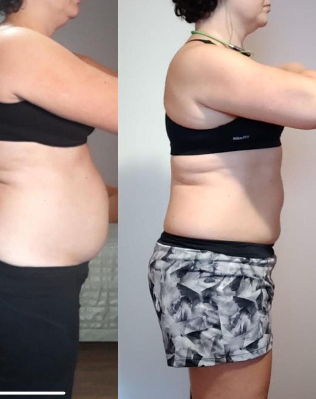antes e depois